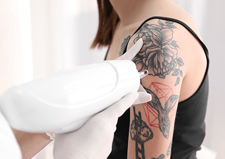 Eyeliner Tattoo Removal Melbourne 175 AUD
